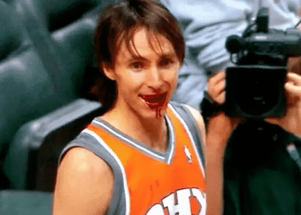 Mouth Guards prevent Basketball Related Mouth Injuries